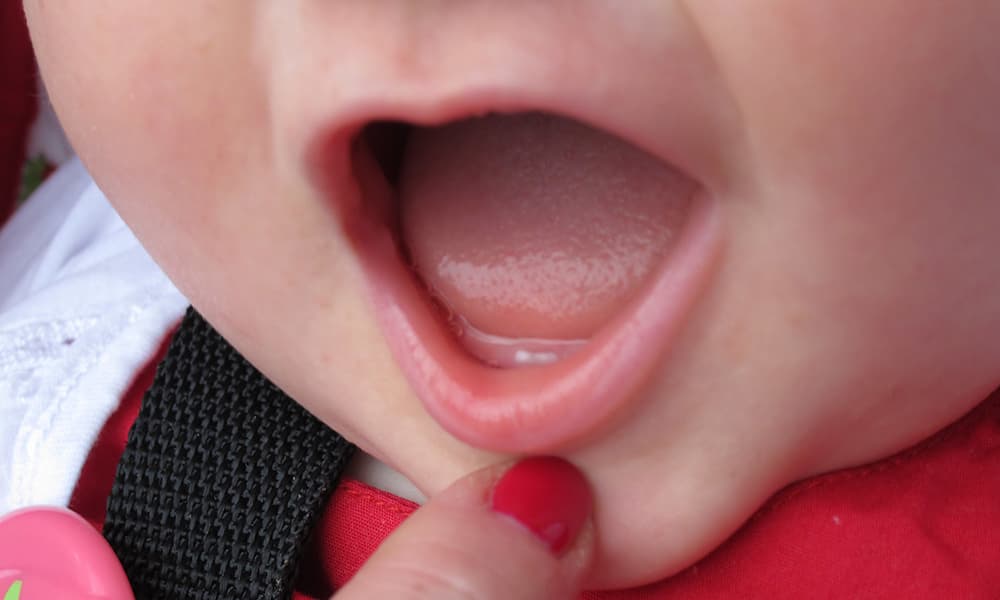 Os 5 principais cuidados com os primeiros dentinhos do bebê